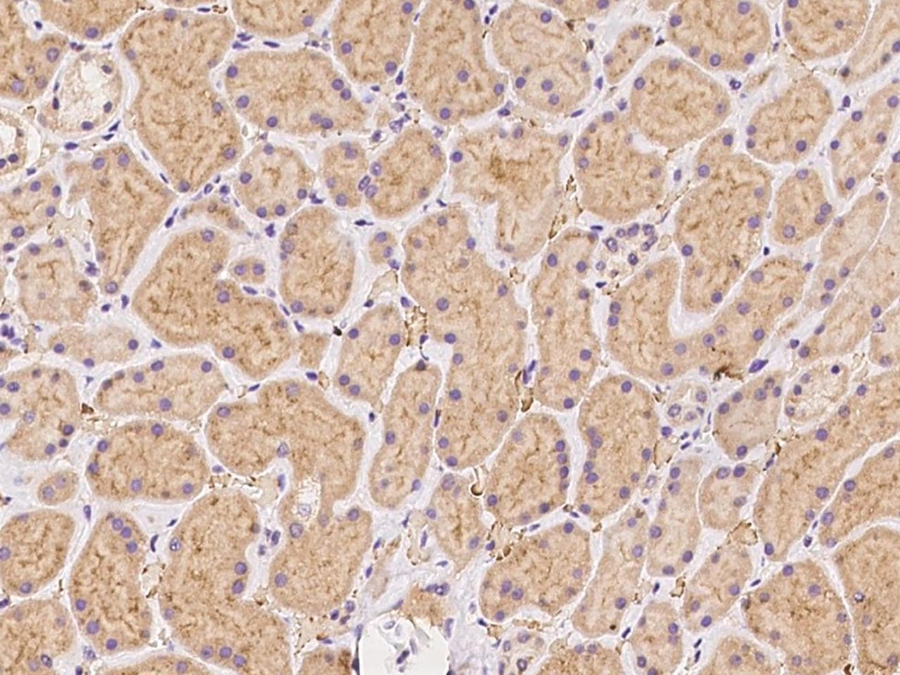 C1orf93 Antibody
