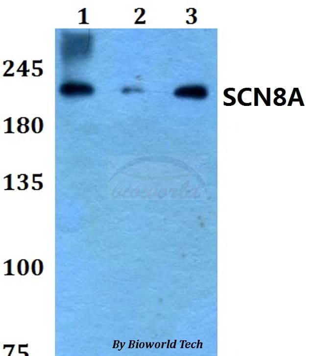 SCN8A / Nav1.6 Antibody