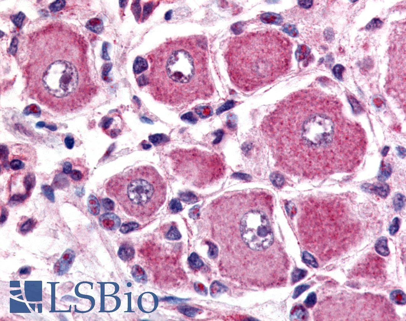 IHC-plus™ GPR149 / PGR10 Antibody (C-Terminus)