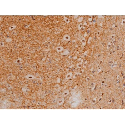 CREB1 / CREB Antibody (phospho-Ser133)