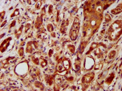 Polyclonal Rabbit anti-Human LRRC45 Antibody (IHC, IF)