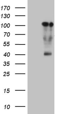 TCF12 / HEB Antibody (clone OTI1F11)