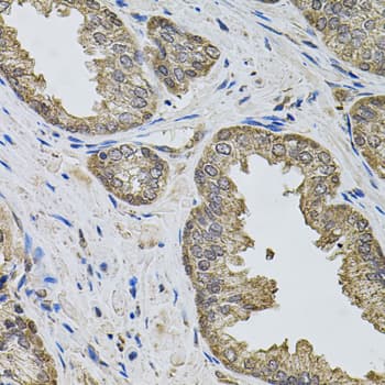 Polyclonal Rabbit anti-Human IGSF3 Antibody (IHC)