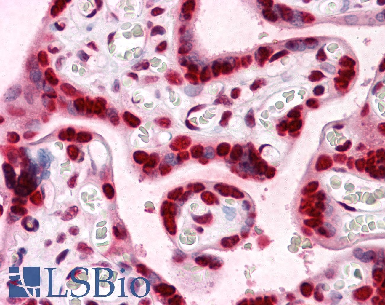IHC-plus™ Monoclonal Mouse anti-Human HMG2 / HMGB2 Antibody (clone 3D2, IHC, IF, WB)