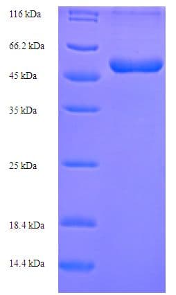 Mouse ABHD11 Protein (Recombinant His-SUMO)