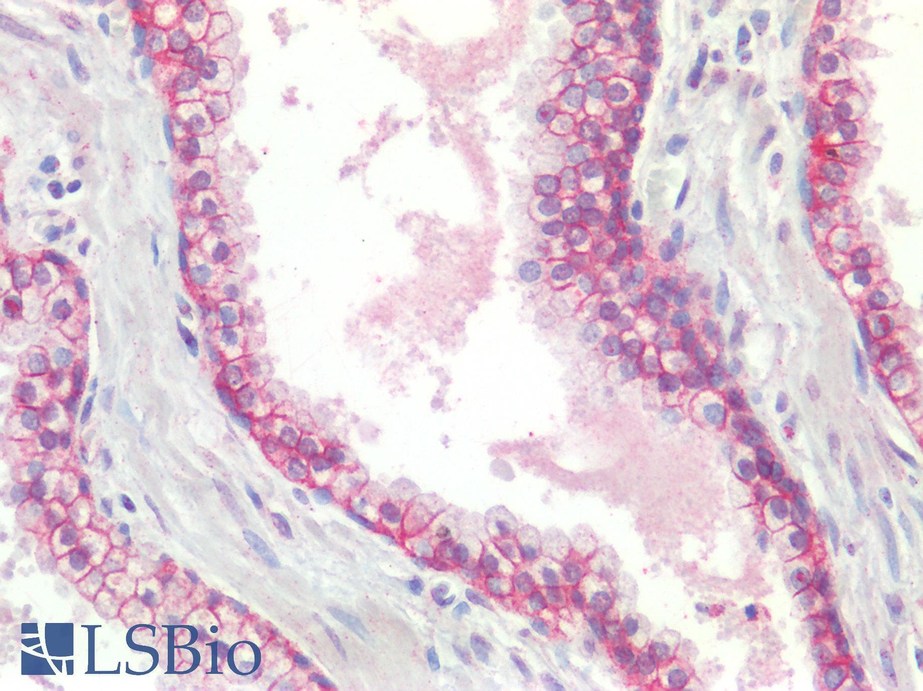 PathPlus™ CTNND1 / p120 Catenin Antibody