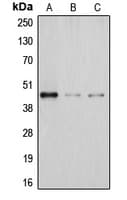 Polyclonal Rabbit anti-Human DHPS Antibody (Internal, WB)