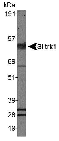 SLITRK1 Antibody
