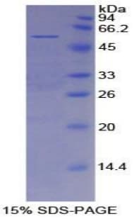 Mouse MSLN / Mesothelin Protein (Recombinant His-GST)