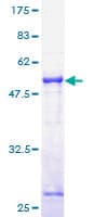 Human TOR1A / Torsin A Protein (Recombinant GST)