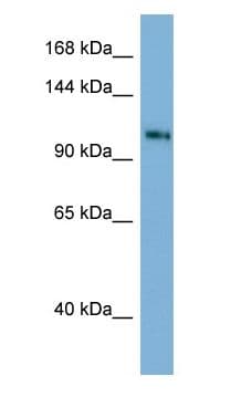 TSC22D1 / TSC22 Antibody (C-Terminus)