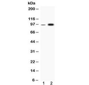 Polyclonal Rabbit anti-Human FGA / Fibrinogen Alpha Antibody (WB)