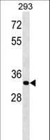 ELOVL4 Antibody (aa286-314)