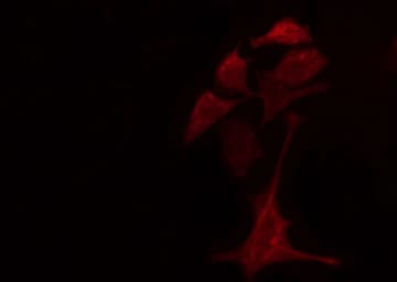 RPL28 / Ribosomal Protein L28 Antibody