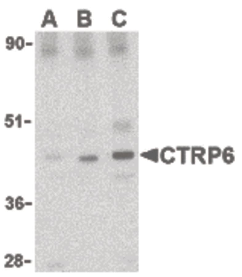 IHC-plus™ C1QTNF6 / CTRP6 Antibody