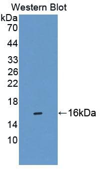 CBY1 / PGEA1 Antibody (aa12-115)