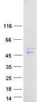 Human GOT1L1 Protein (Recombinant Myc-DDK (Flag))