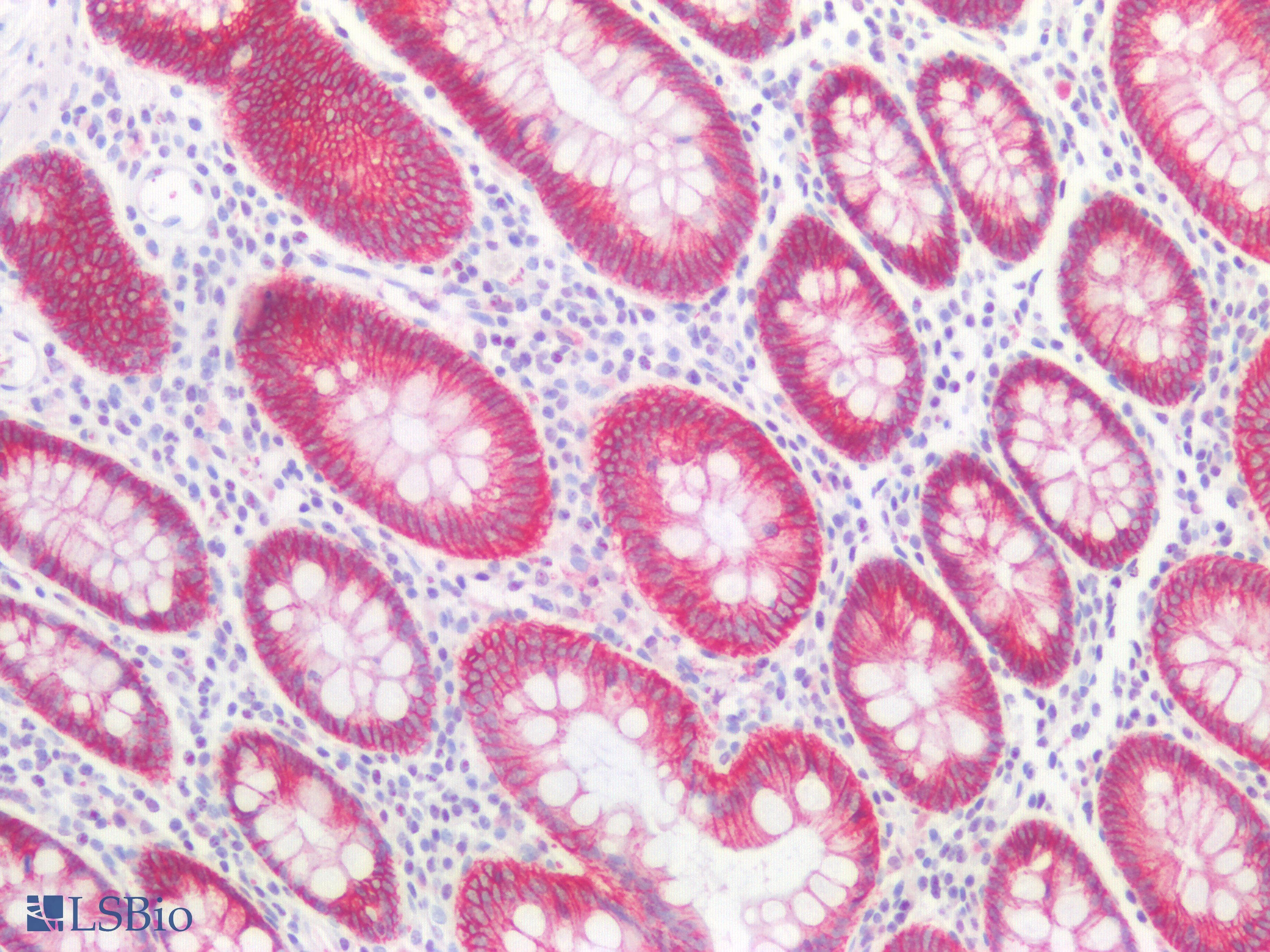 PathPlus™ CDH1 / E Cadherin Antibody (N-Terminus)