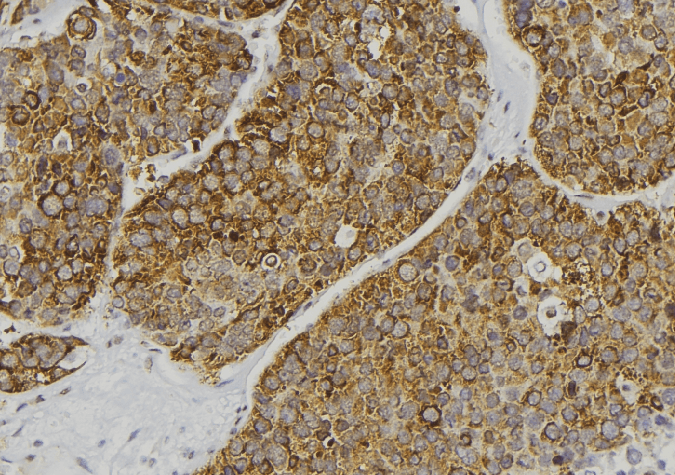 STXBP4 Antibody