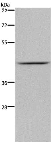 JMJD6 / PSR Antibody