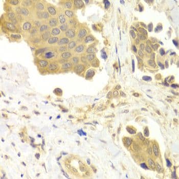 GABARAP Antibody