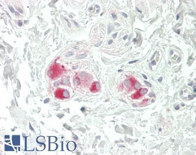 IHC-plus™ Polyclonal Rabbit anti-Human CD118 / LIF Receptor Alpha Antibody (aa1021-1055, IHC, WB)