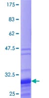 Human TNP1 / TP1 Protein (Recombinant GST)