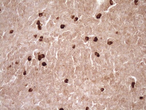 Monoclonal Mouse anti-Human MMP3 Antibody (clone OTI1E9, aa246-477, IHC, WB)