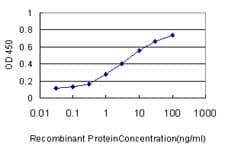 IHC-plus™ SAE1 Antibody (clone 1G4-1G5)