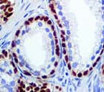 RABEPK / p40 Antibody (clone ZR8)