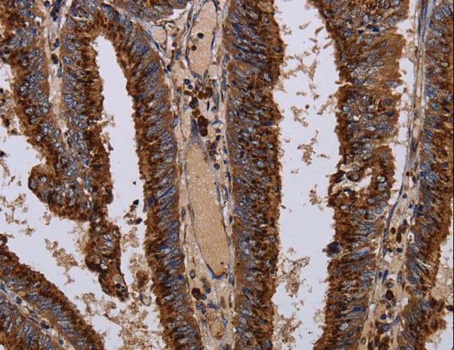PPP1R1B / DARPP-32 Antibody