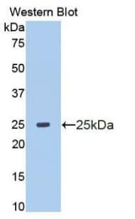 MMP13 Antibody (aa103-290, Cy3)