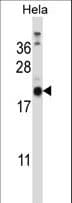 Polyclonal Rabbit anti-Human PRGP1 / PRRG1 Antibody (aa30-59, WB)