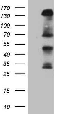IRS1 Antibody (aa1-280, clone OTI9E11)