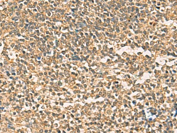 THG1L Antibody