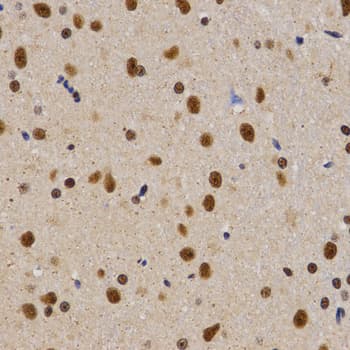 PELP1 Antibody