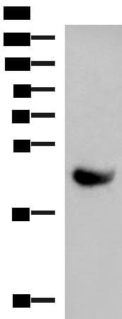 Polyclonal Rabbit anti-Human KIR2DL5A / KIR2DL5 Antibody (IHC, WB)