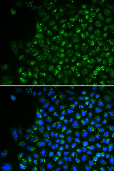 PDHA1 / PDH E1 Alpha Antibody