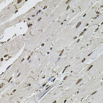 Polyclonal Rabbit anti-Human CTNNB1 / Beta Catenin Antibody (IHC, WB)