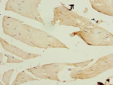 FBXO30 Antibody