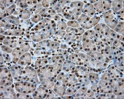 APP / Beta Amyloid Precursor Antibody (clone OTI5F1)