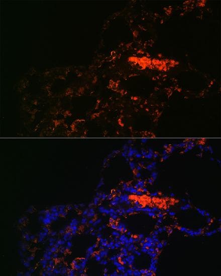 Polyclonal Rabbit anti-Human ABCG1 Antibody (IF)