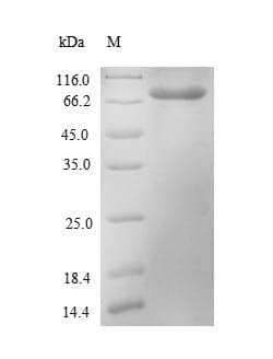 E. coli Polymyxin resistance protein MCR-1 (Recombinant 6His-SUMO, N-terminus)