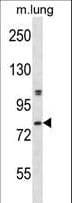 DYRK4 Antibody (aa536-563)