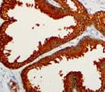 KLK3 / PSA Antibody (clone RBT-PSA, Ready-to-Use)