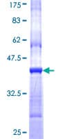 Human CHRND Protein (Recombinant GST, N-terminus)