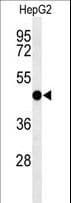 SMS2 / SGMS2 Antibody (aa338-365)