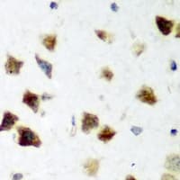 PPP1CC / PP1 Gamma Antibody