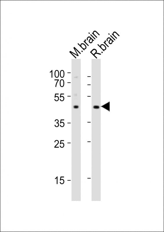Polyclonal Rabbit anti-Human NPY2R Antibody (aa29-65, WB)