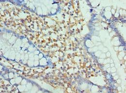 ENPP2 / Autotaxin Antibody (aa564-863)